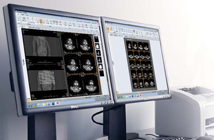 CT/MR圖像與信息管理系統(tǒng)